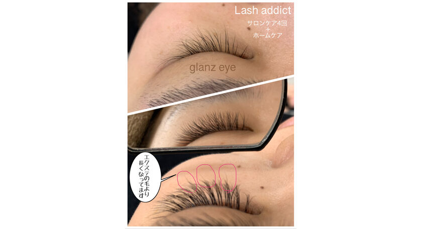 まつ育・まゆ育ならLash addict（ラッシュアディクト）正規導入店 